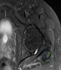 صورة توضيحية لـ إصابات الملاعب وجراحة العظام: دليل شامل من الأستاذ الدكتور محمد هطيف في صنعاء