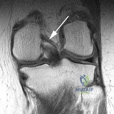صورة طبية: دليل شامل لصحة العظام والمفاصل: استشارات وإجابات مع الأستاذ الدكتور محمد هطيف في صنعاء