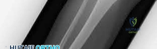 Orthopedic MCQs: Ace Trauma Plating & Nerve Injury Exams