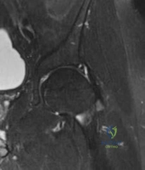 صورة توضيحية لـ إصابات الملاعب وجراحة العظام: دليل شامل من الأستاذ الدكتور محمد هطيف في صنعاء