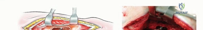 صورة توضيحية لتقييم المريض قبل الجراحة