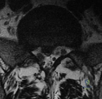Clinical Image