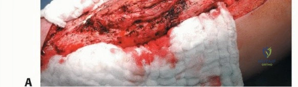 وصف طبي دقيق للمريض