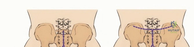 Illustration of bowel and bladder - Dr. Mohammed Hutaif