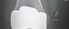 التدخل الجراحي