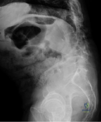 Clinical Image