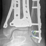 Clinical Image