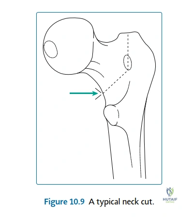 Clinical Image