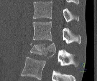 Clinical Image