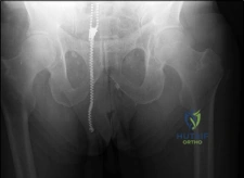 صورة طبية: جراحة استبدال مفصل الركبة التقوسي: الحل النهائي لآلام الركبة في صنعاء | الأستاذ الدكتور محمد هطيف