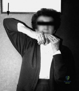 الفحص السريري لآلام الكتف