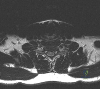 Clinical Image