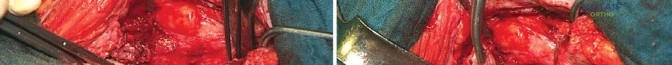 Pediatric Orthopaedic Board Review MCQs | ABOS & OITE