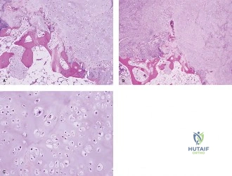 Clinical Image