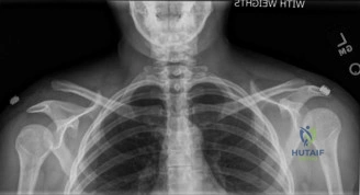 صورة توضيحية لنطاق الحركة