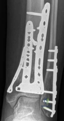 Clinical Image