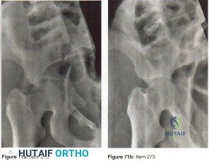 صورة طبية: دليلك الشامل لأمراض وإصابات العظام والمفاصل في اليمن: خبرة الأستاذ الدكتور محمد هطيف في صنعاء