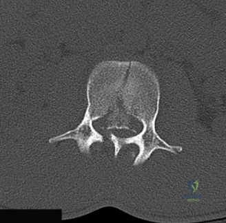 Clinical Image