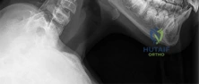 OITE & ABOS Orthopedic Board Prep: Practice Exam Part 2