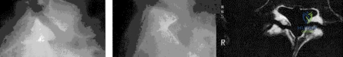 صورة توضيحية لـ دليلك الشامل لأمراض وإصابات العظام والمفاصل في اليمن: خبرة الأستاذ الدكتور محمد هطيف في صنعاء