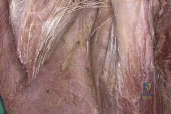 صورة طبية: دليل شامل لكسور وإصابات الجهاز الحركي: رعاية متقدمة في صنعاء مع الأستاذ الدكتور محمد هطيف