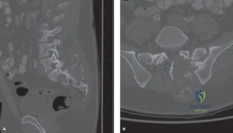 Clinical Image