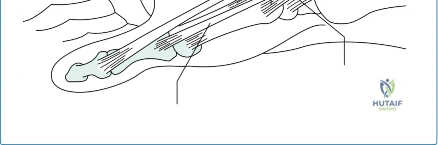 صورة طبية: جراحة الرسغ المتقدمة: دليل شامل لخيارات العلاج والتعافي مع الأستاذ الدكتور محمد هطيف في صنعاء