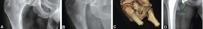 FRCS Mock Exam 5: Rapid Fire Challenge