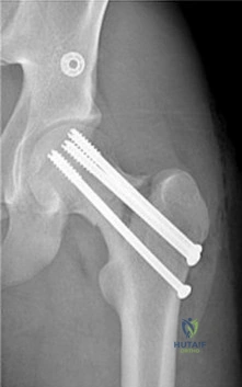 "Guide to finding the best orthopedic surgeon in Yemen: Factors to Consider for Successful Outcomes"