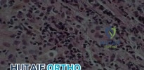 هيكل العظام وتوزيع الأحمال الحركية في الجسم