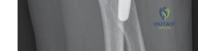 Clinical Image