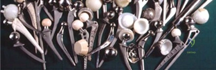 Illustration 2 for Maximizing Durability: Tribology and Bearing for Hip Implants