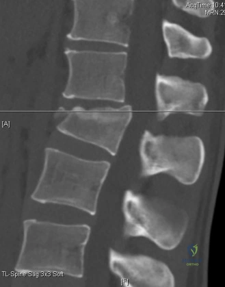 Clinical Image