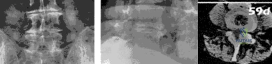 صورة طبية: دليلك الشامل لأمراض وإصابات العظام والمفاصل في اليمن: خبرة الأستاذ الدكتور محمد هطيف في صنعاء