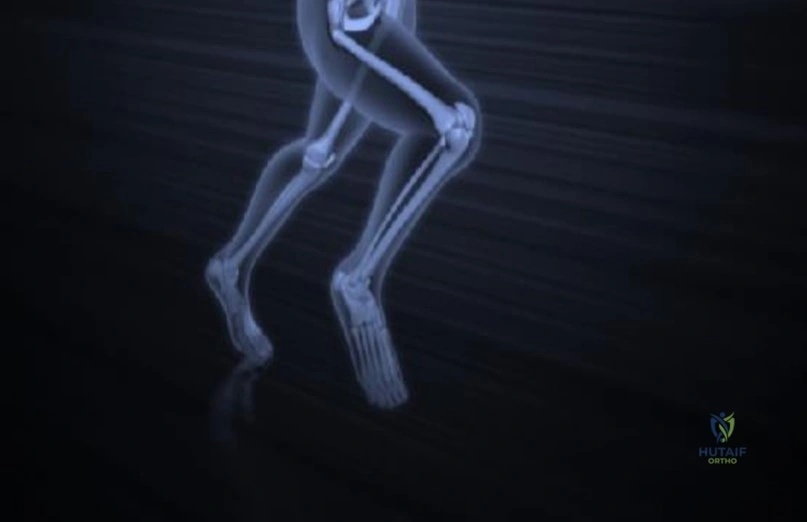 Orthopedic Board Review MCQs (2026 Edition) - Part 3