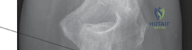 Clinical Image