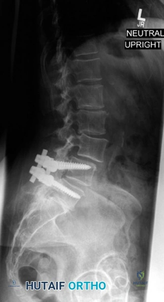 Clinical Image