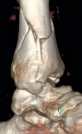 Clinical Image