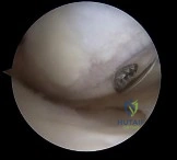 صورة طبية: دليل شامل لصحة العظام والمفاصل: استشارات وإجابات مع الأستاذ الدكتور محمد هطيف في صنعاء