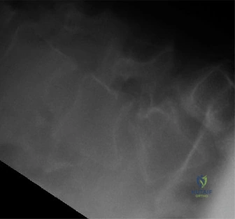 Clinical Image