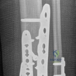 Clinical Image