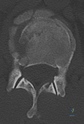Clinical Image