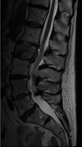 Clinical Image