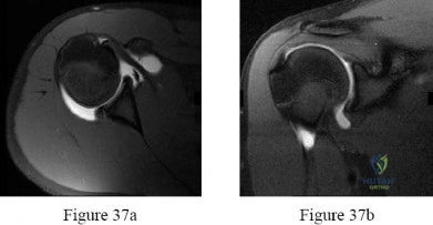 Orthopedic Surgery Mock Exam - Set D14A91