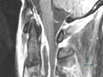 Clinical Image