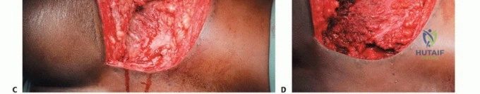الأستاذ الدكتور محمد هطيف في غرفة العمليات