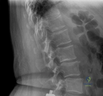 Clinical Image