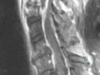 Clinical Image
