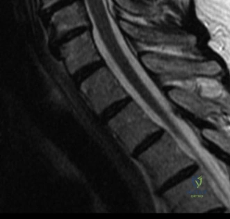 Clinical Image