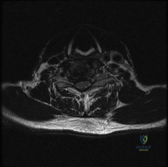Clinical Image